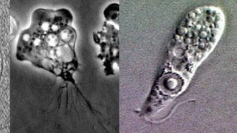 腦部感染「食腦蟲」致死率達9成。（圖／翻攝自美國疾病管制中心CDC）